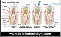 Holistic Dentistry Berkeley Heights, NJ image 5